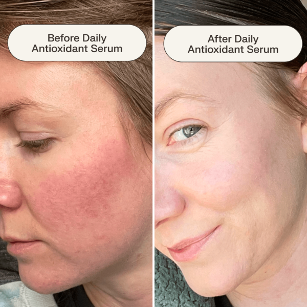 Daily Antioxidant Serum